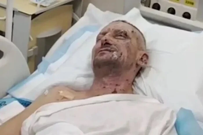 Єдиний, хто вижив: журналіст Freedom розповів, як російський дрон убив його колег
